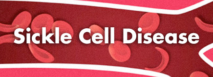 sickle cell anemia Port Arthhur, sickle cell Jasper TX, sickle cell anemia East Texas, sickle cell Orange TX